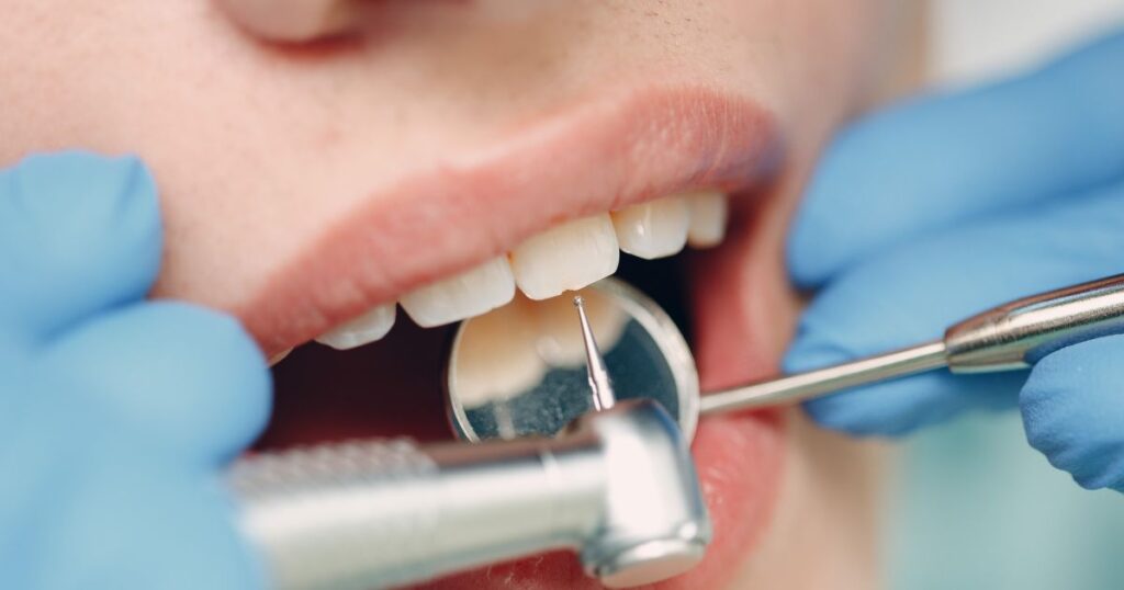 Programa de Odontología PyP